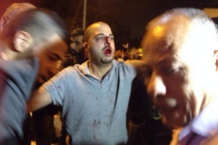 עו"ד וסים חוסרי אחרי ההתקפה (בהאא מחמאיד)