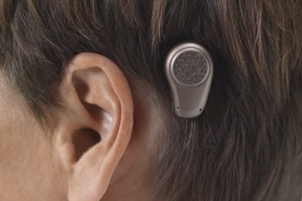 עזר שמיעה (צילום: Oticon Medical ויקימדיה CC BY-SA 3.0)