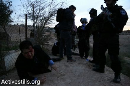 ח"כ עודה פצוע באום אל חיראן לפנות בוקר (צילום: קרן מנור, אקטיבסטילס)